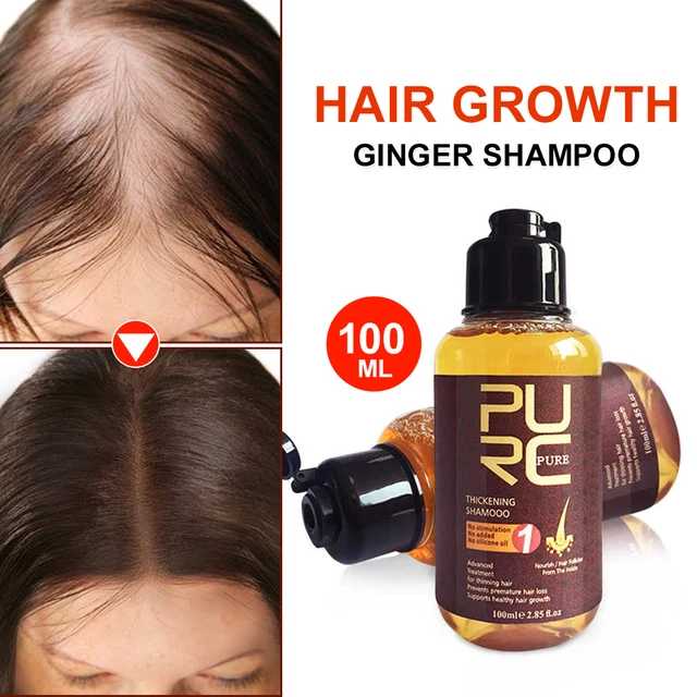 szampon na porost włosów allieexpree
